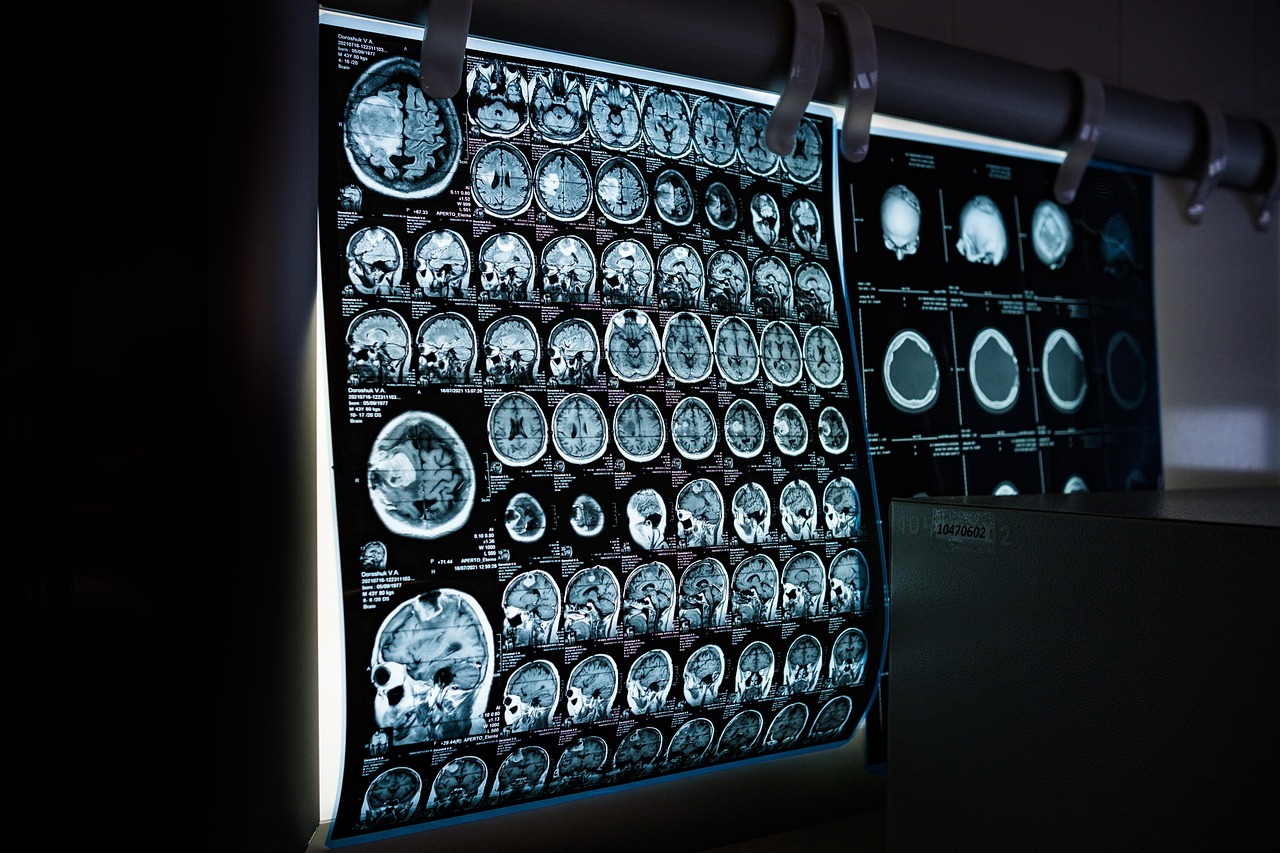 Brain-Scanning ermöglicht Gedankenlesen